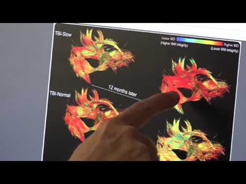 A biomarker in children with traumatic brain injuries could improve recovery | UCLA Health Newsroom