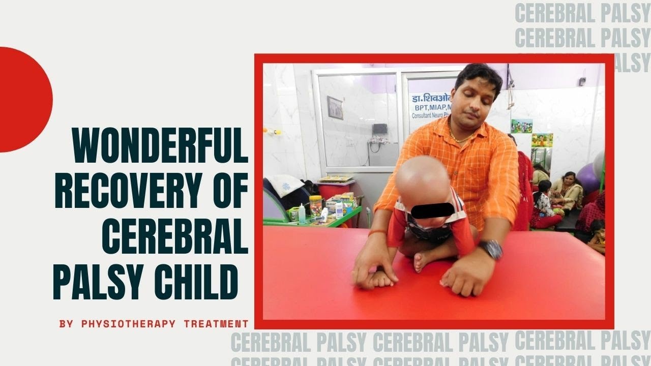 wonderful recovery of cerebral palsy child by physiotherapy treatment