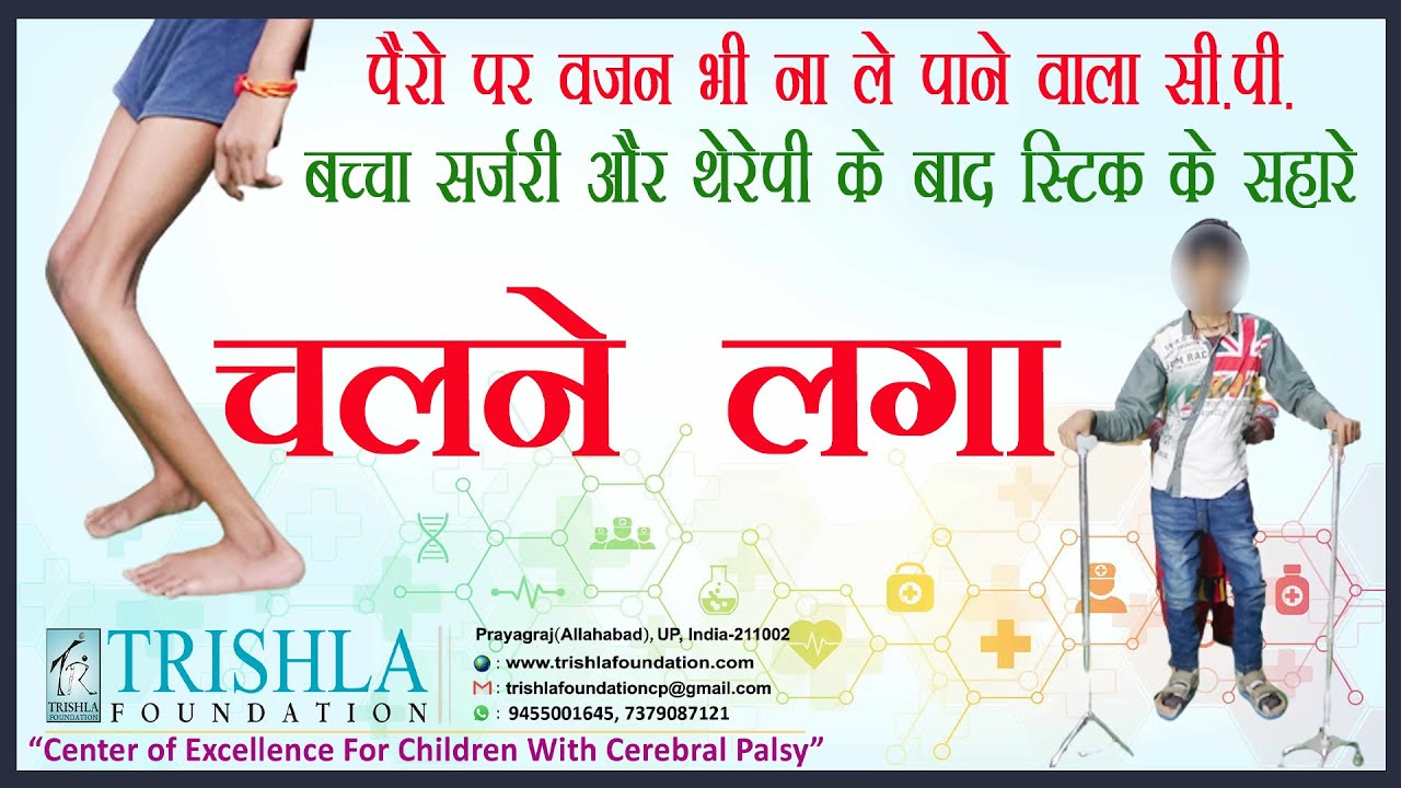 CP Success Story: Excellent Recovery of Child with Cerebral Palsy & Crouch Gait | Trishla Foundation