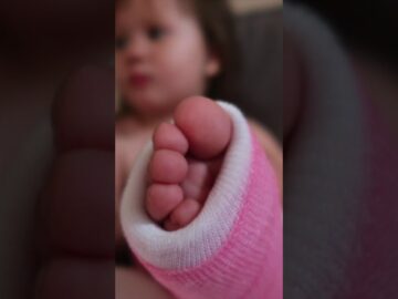 #Shorts Toddler Broken Leg & Recovery 7 Week Recap | Child Walking with Leg Cast