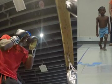 Shriners Children’s Hospital helps future boxer on his road to recovery