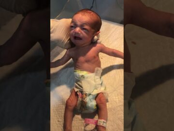 Cute Little Baby in NICU 👶💖 | Brave Newborn Fighter 🙏 #NICUBaby #CuteBaby