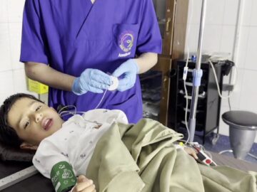 Pediatric Anesthesia: Induction, Intubation & Recovery | Step-by-Step Guide