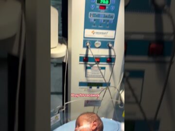 pray for recovery #reels #baby #cutebaby #newborn #nicuwarrior