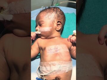 Nicu baby , pray for recovery ❤️🩹 #baby #childcare #love #viral
