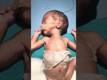 Very low birth weight baby in nicu , please pray for fast recovery ❤️🩹 #nicu #baby #love #viral