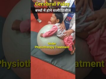 (सेरेब्रल पाल्सी) Cerebral Palsy #physiodrdeepaksoni #cerebralpalsy