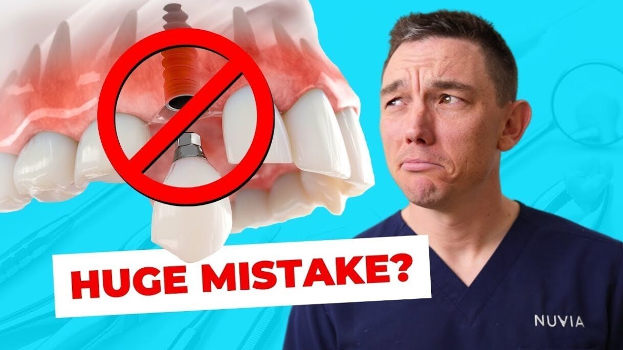 Why You Should NOT Get Dental Implants in 2026