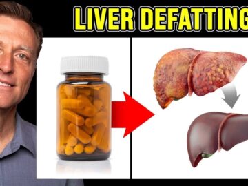 The BEST Vitamin to Cleanse a Fatty Liver – Dr. Berg