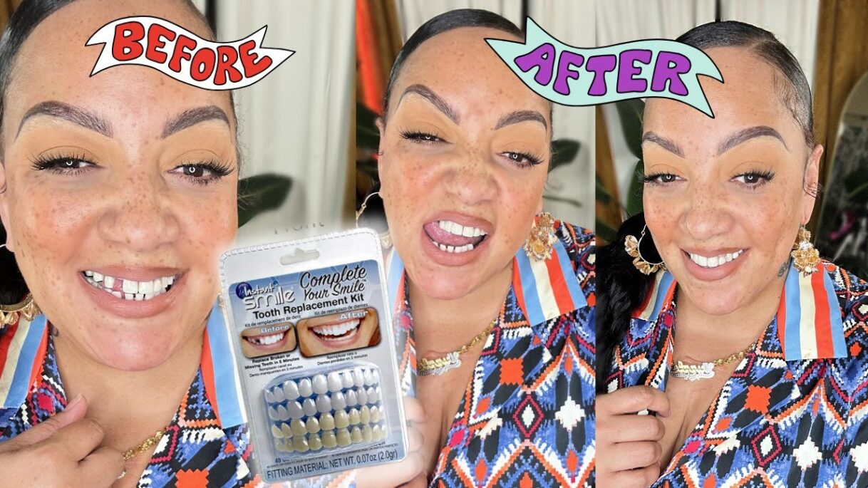 I Bought a Tooth from Amazon! How I Fixed My Missing Front Tooth It Looks So Real!