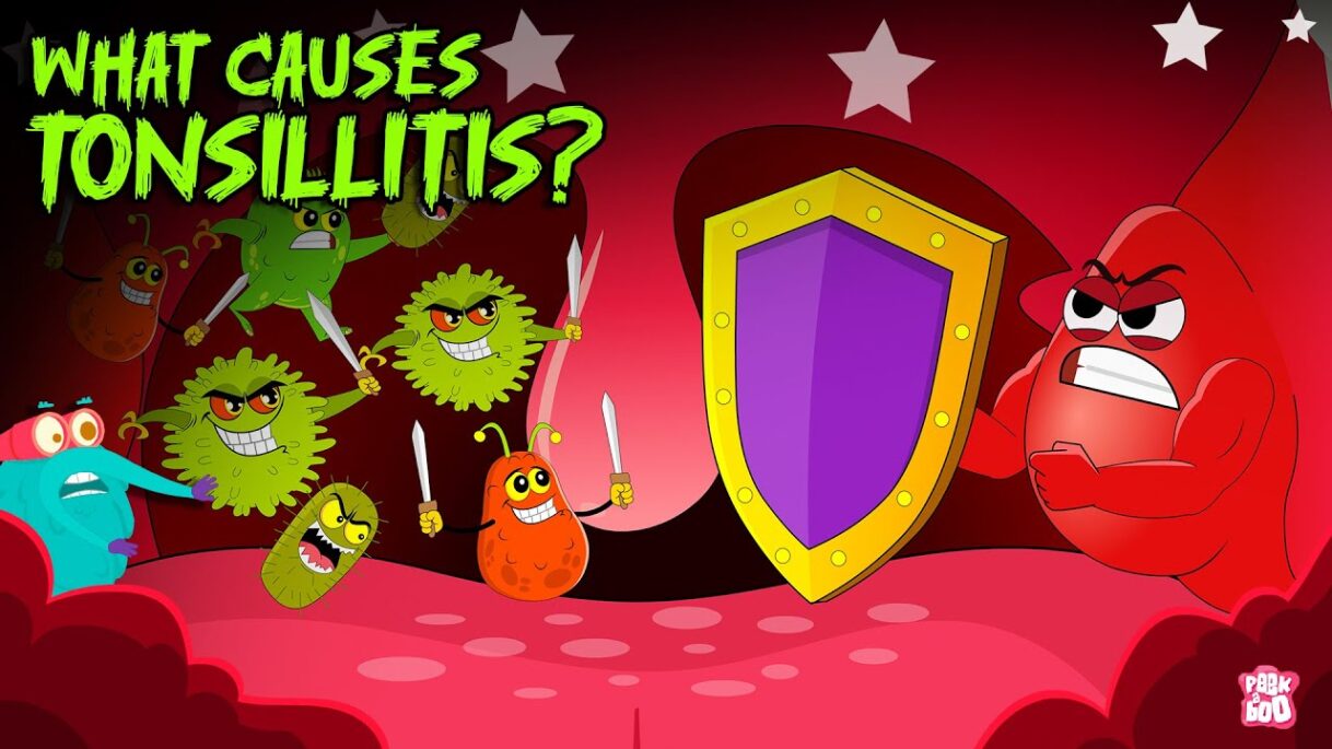 What Causes Tonsillitis? | Tonsils Symptoms & Treatments | Bacterial Infections | Dr. Binocs Show
