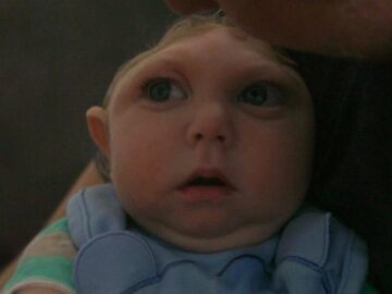 ‘Miracle Baby’ Born Without Most of His Brain Defying Odds | ABC News