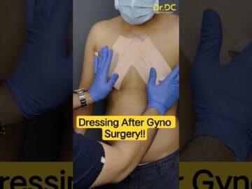 Gynecomastia First Dressing Care: Gynecomastia Surgery Recovery! | Dr DC, Pune